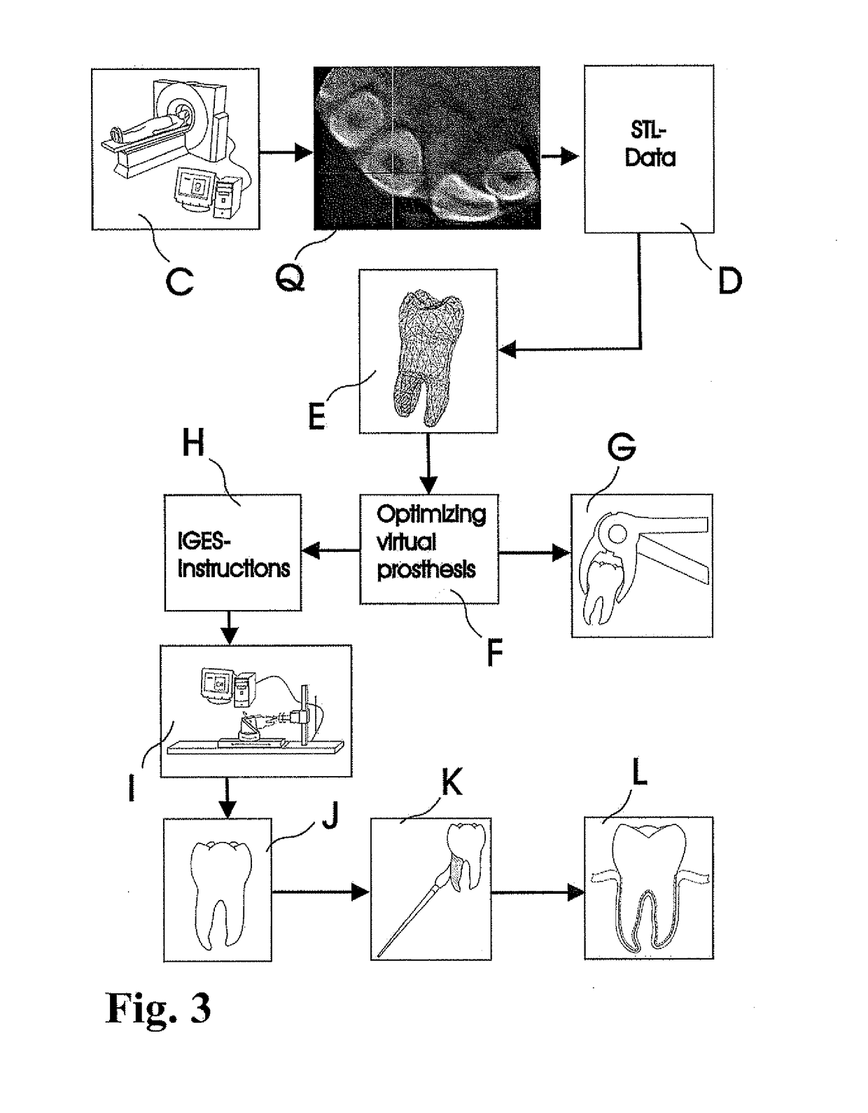 Methods of Designing and Manufacturing Customized Dental Prosthesis For Periodontal or Osseointegration and Related Systems