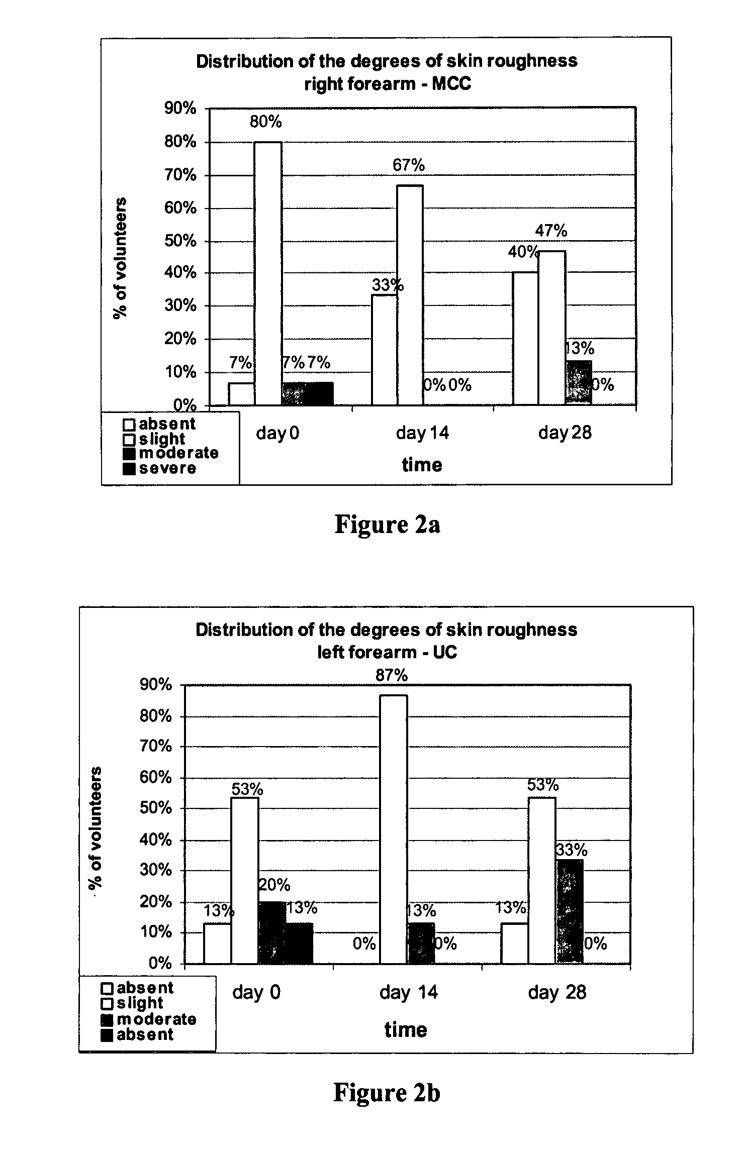 Topical compositions of urea and ammonium lactate