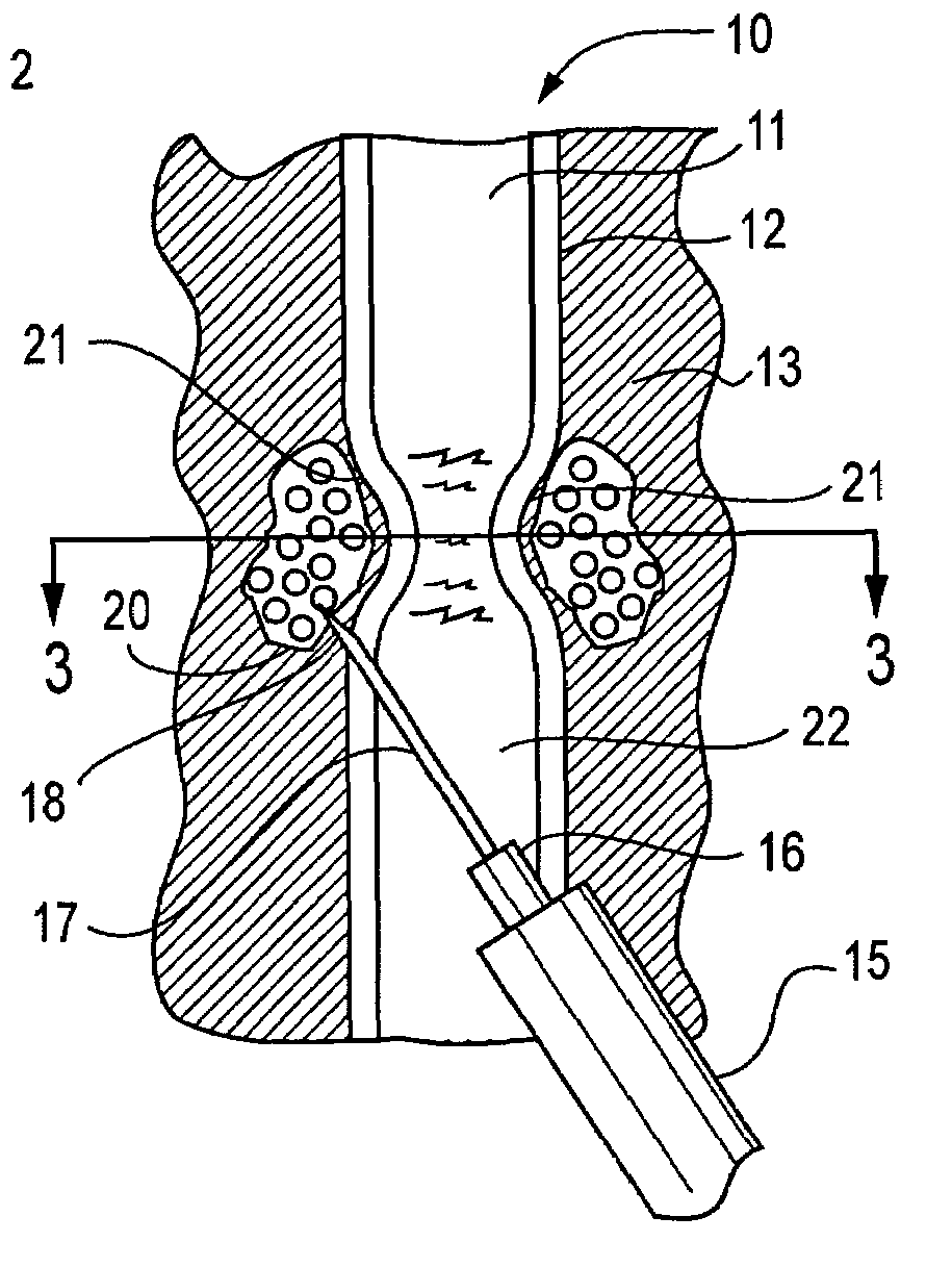 Active tissue augmentation materials and method