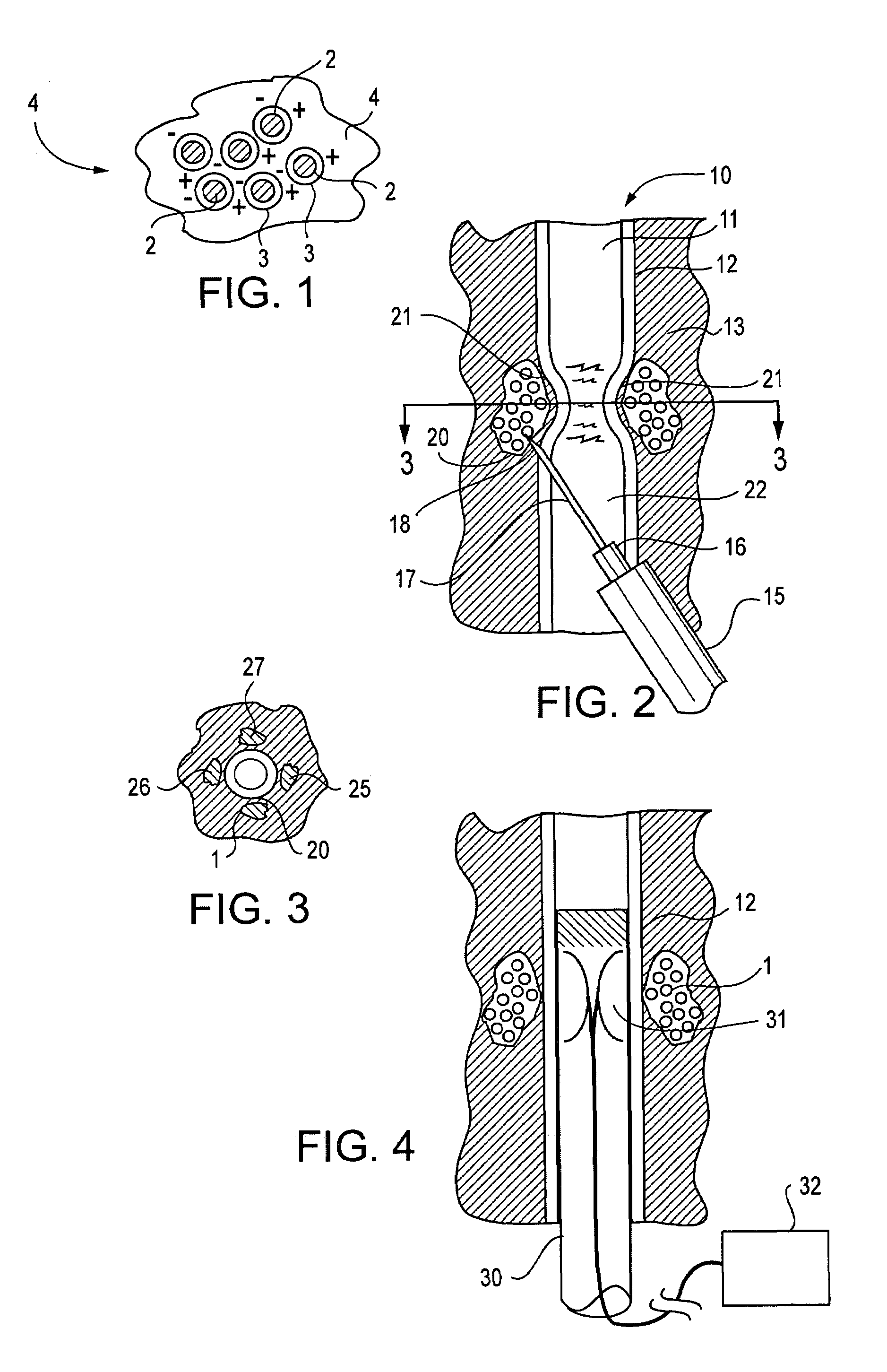 Active tissue augmentation materials and method