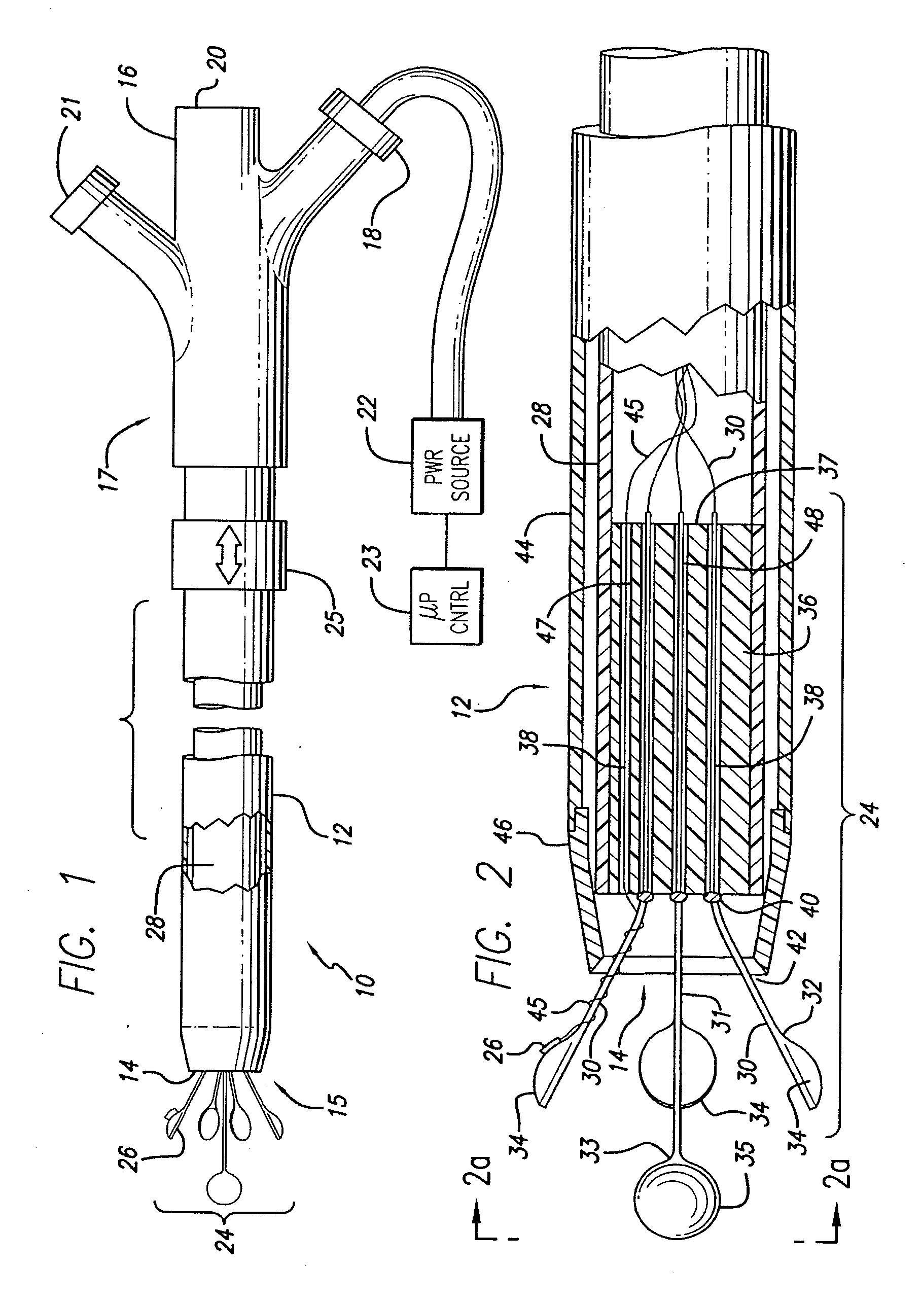 Expandable catheter having two sets of electrodes