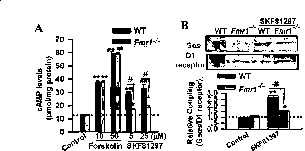 Medicine target point for treating friable X syndrome and application thereof in pharmacy