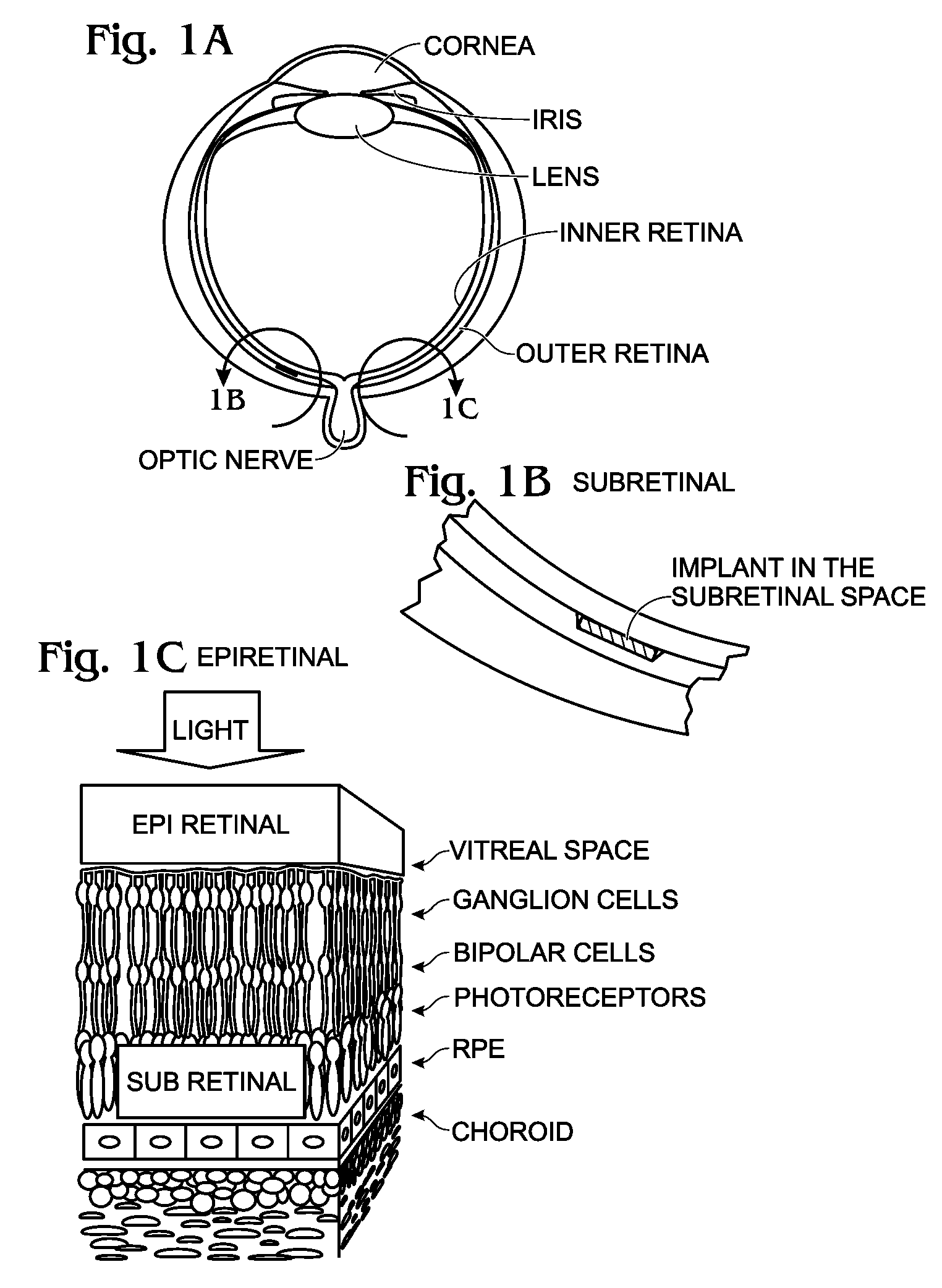 IrOx Nanostructure Electrode Neural Interface Optical Device