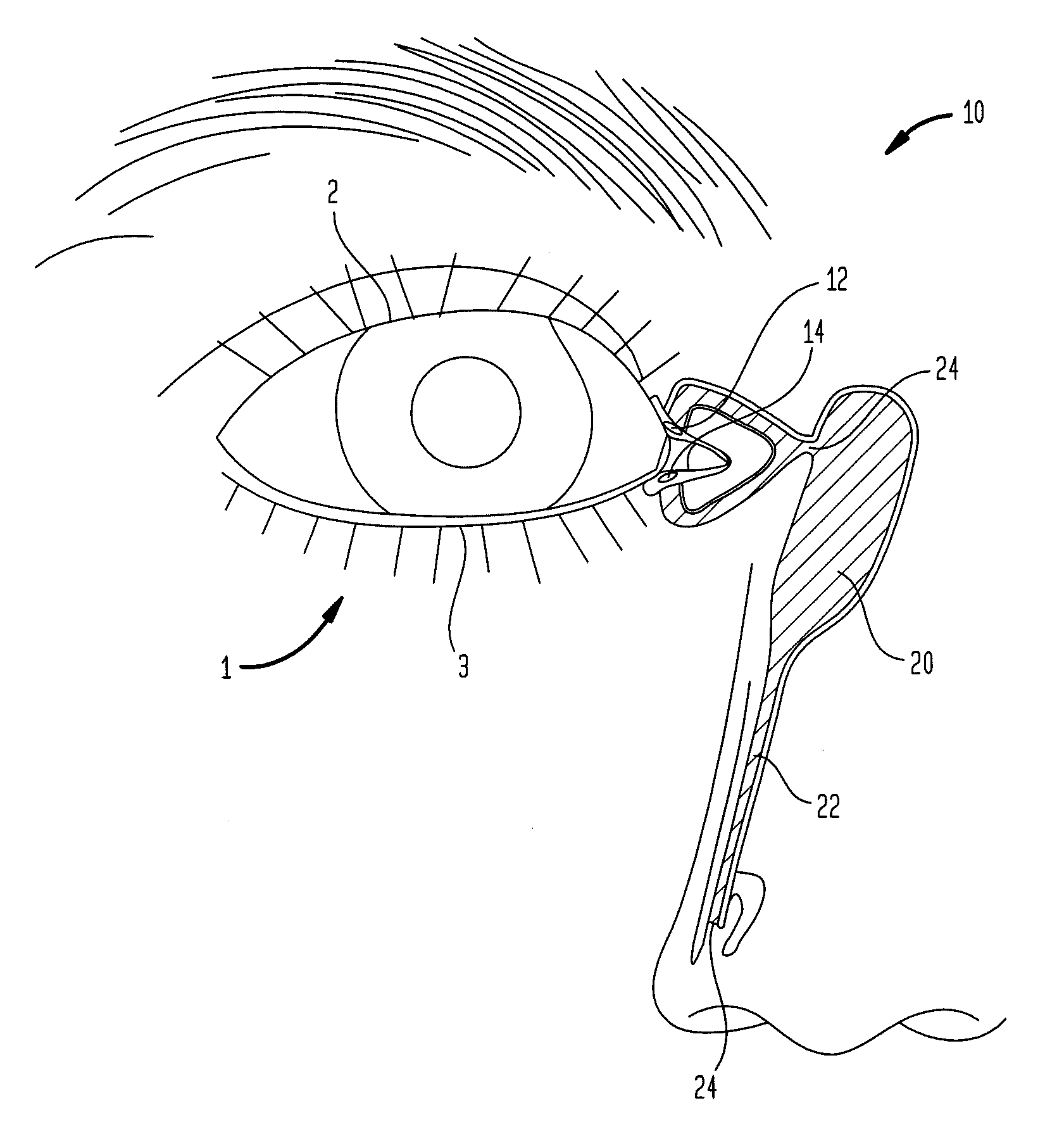 Microelectronic biosensor plug