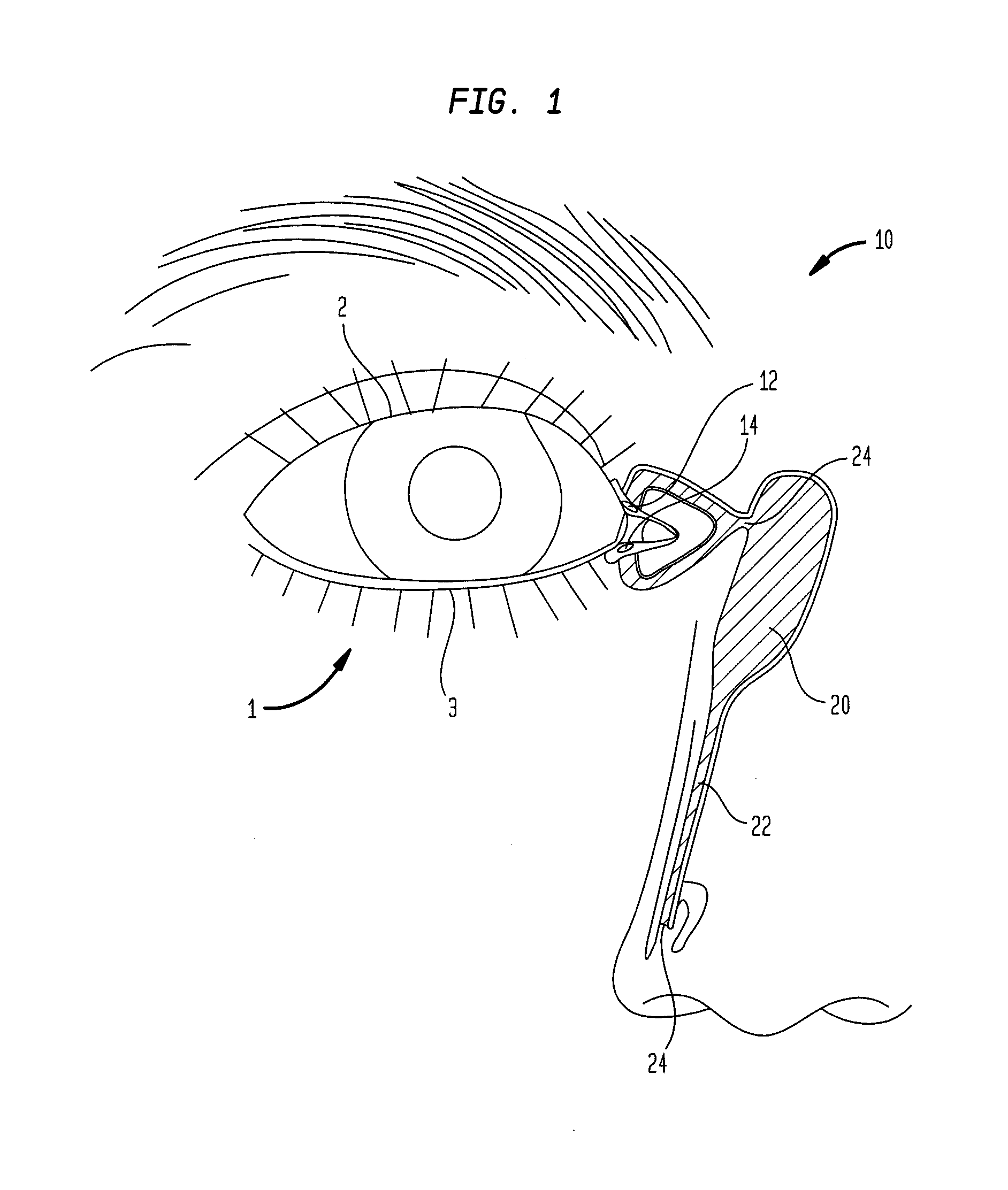 Microelectronic biosensor plug