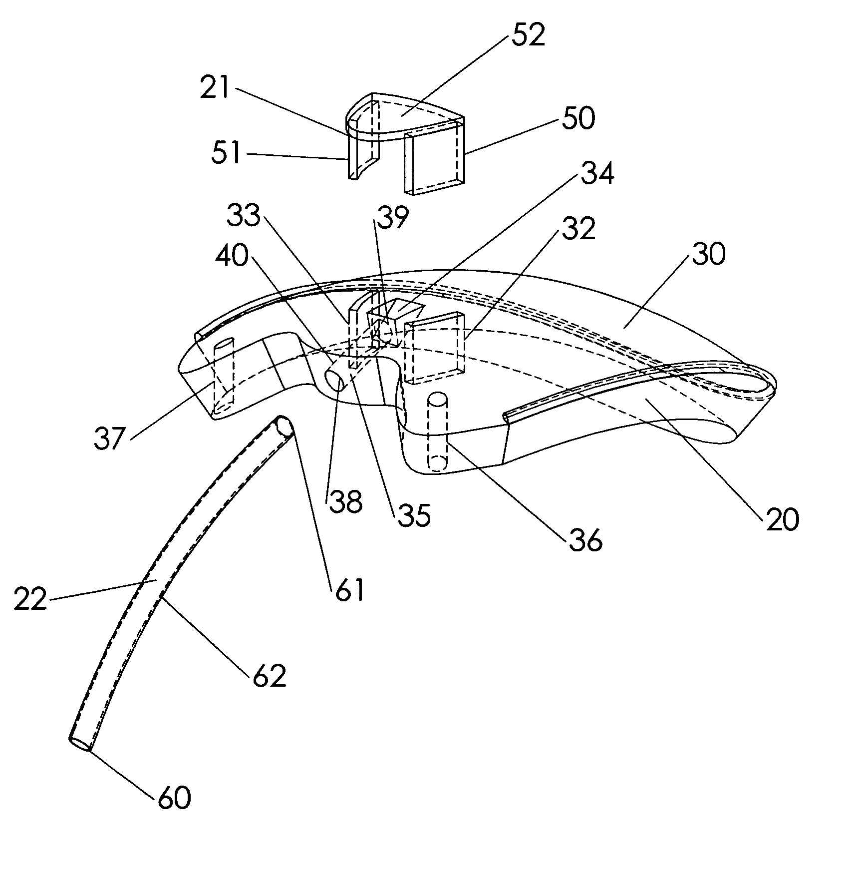 Aqueous drainage and flow regulating implant