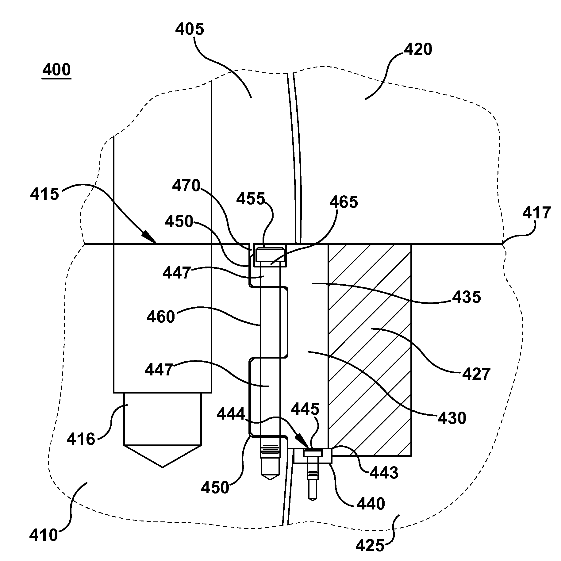 Support bar for turbine diaphragm that facilitates reduced maintenance cycle time and cost