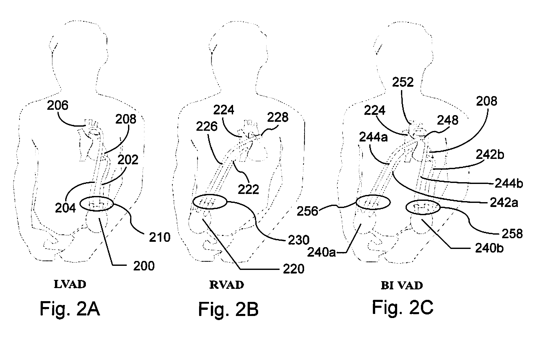 Device and method for connecting a blood pump without trapping air bubbles