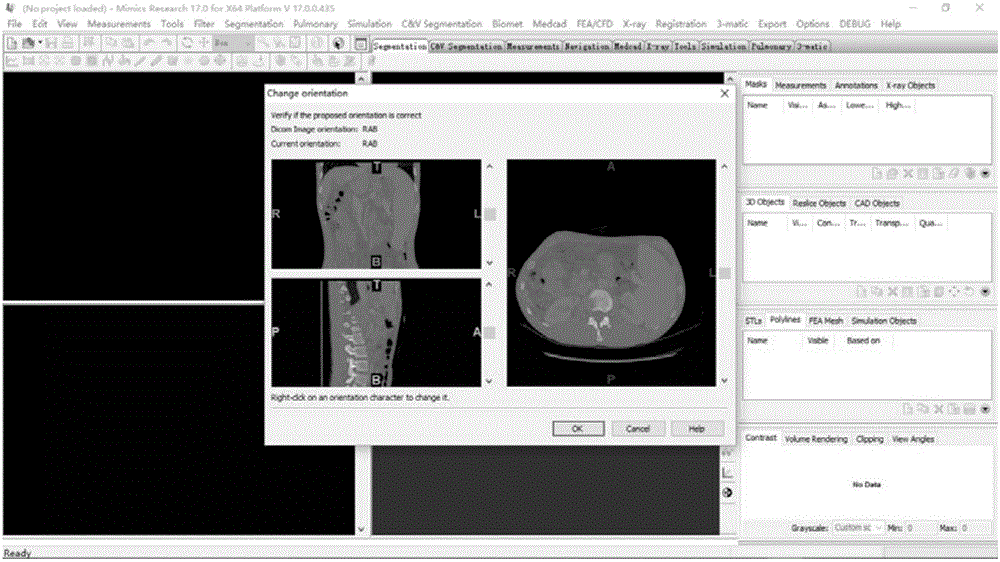 Measurement method of virtual hepatic vein pressure gradient