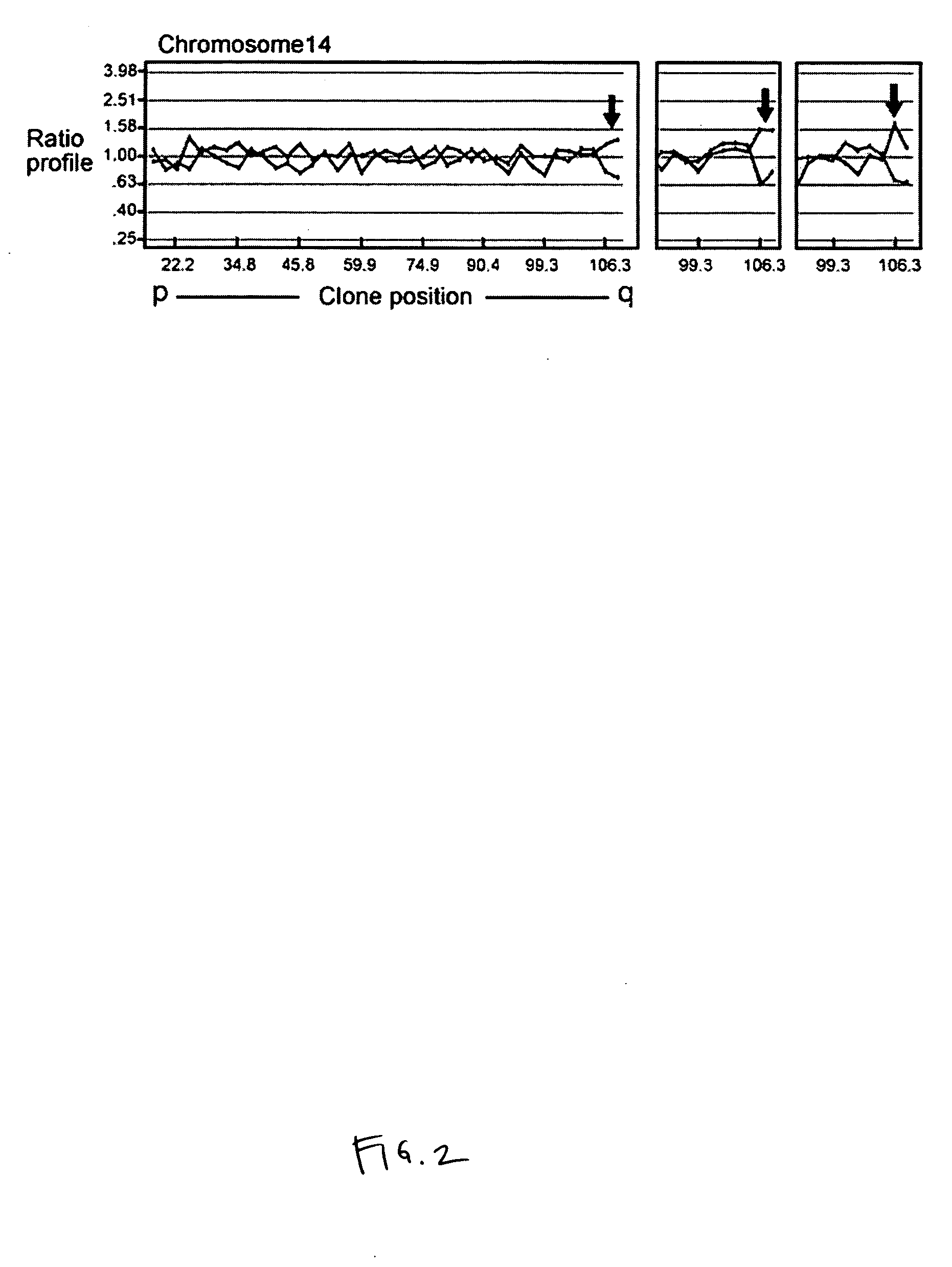 Compositions and methods for diagnosing and treating chronic lymphocytic leukemia