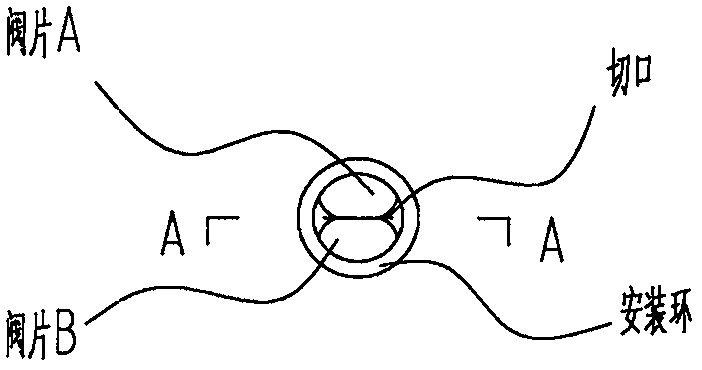 Passive thoracic pressure differential pressure artificial heart and implantation position