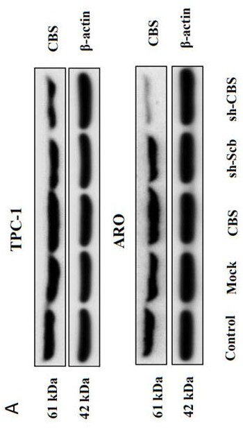 Vector and preparation for knocking down human CBS gene as well as preparation method and application thereof