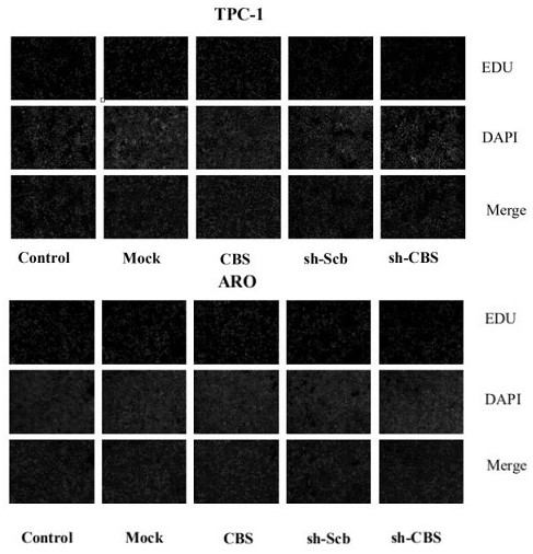 Vector and preparation for knocking down human CBS gene as well as preparation method and application thereof