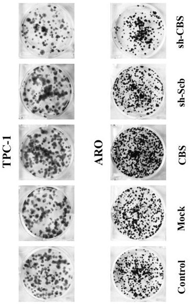 Vector and preparation for knocking down human CBS gene as well as preparation method and application thereof