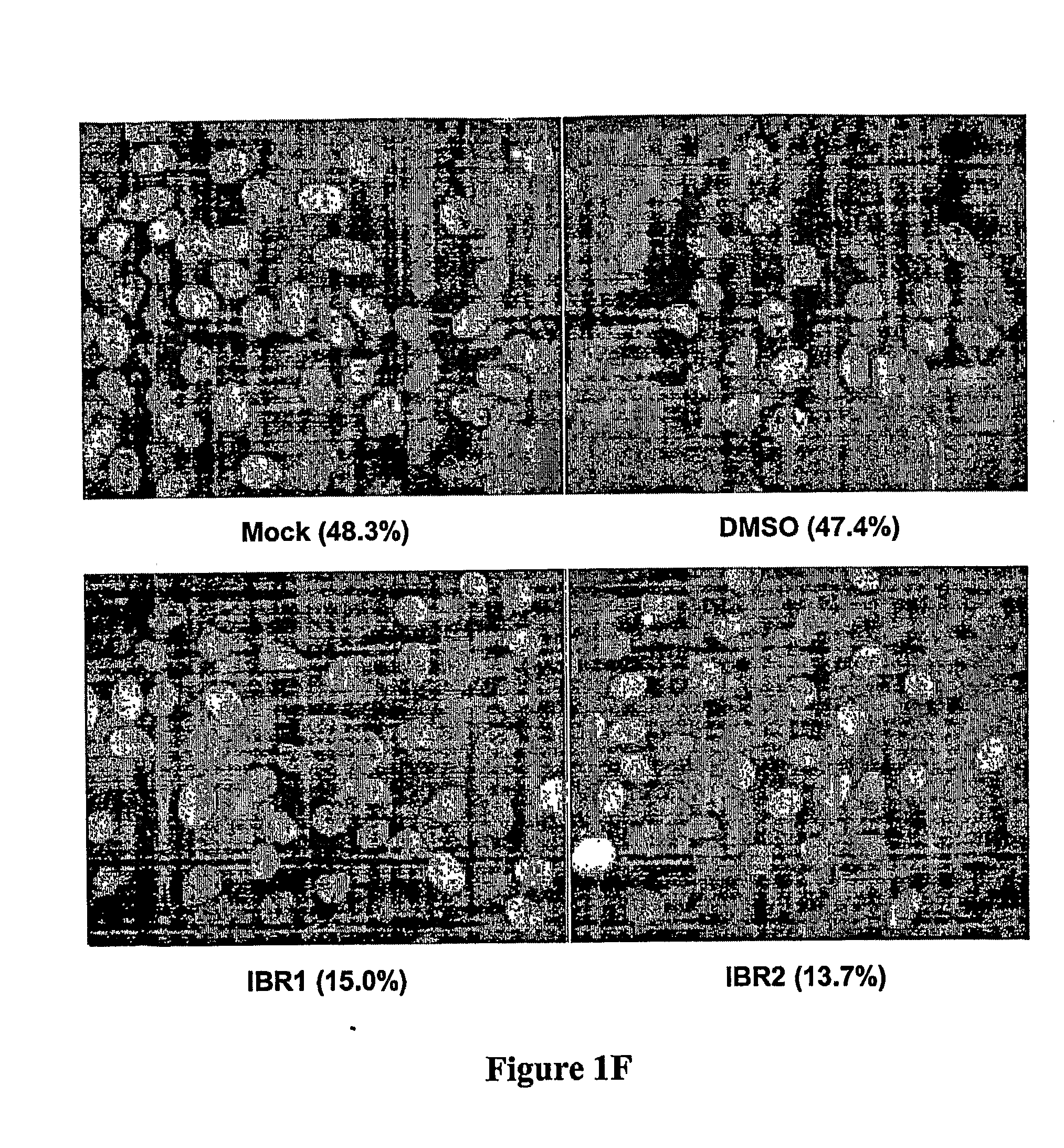 Compositions and Methods for Disruption of BRCA2-Rad51 Interaction