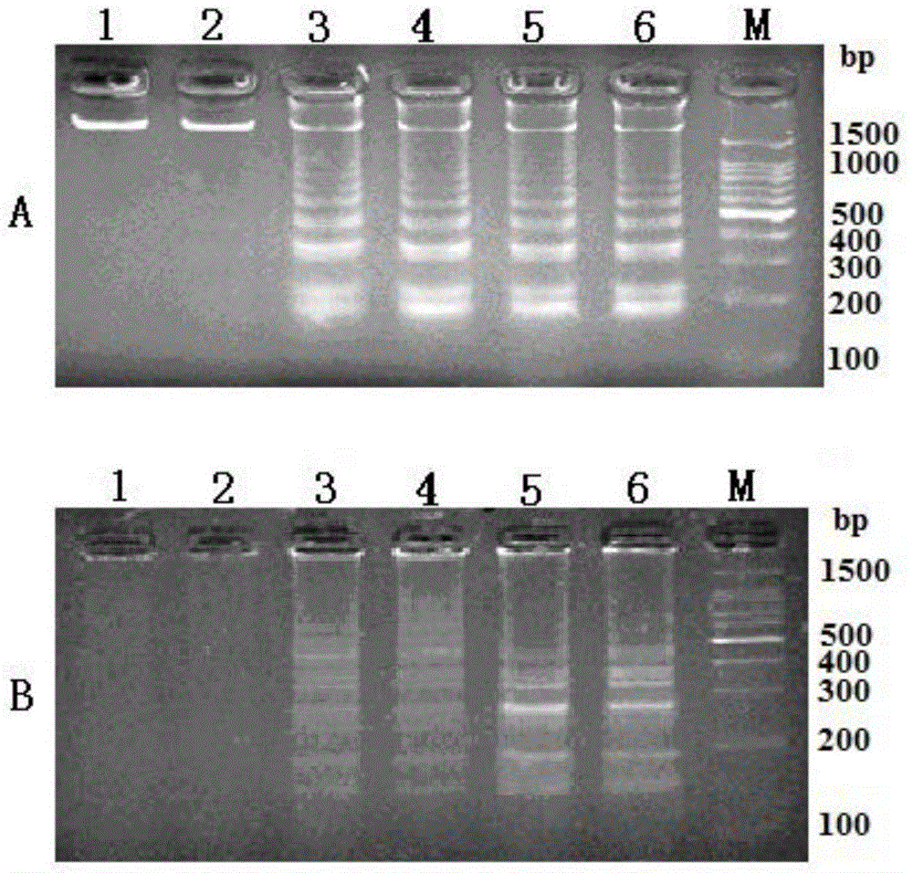 Double-LAMP (loop-mediated isothermal amplification) method for simultaneously detecting vibrio parahaemolyticus and vibrio vulnificus