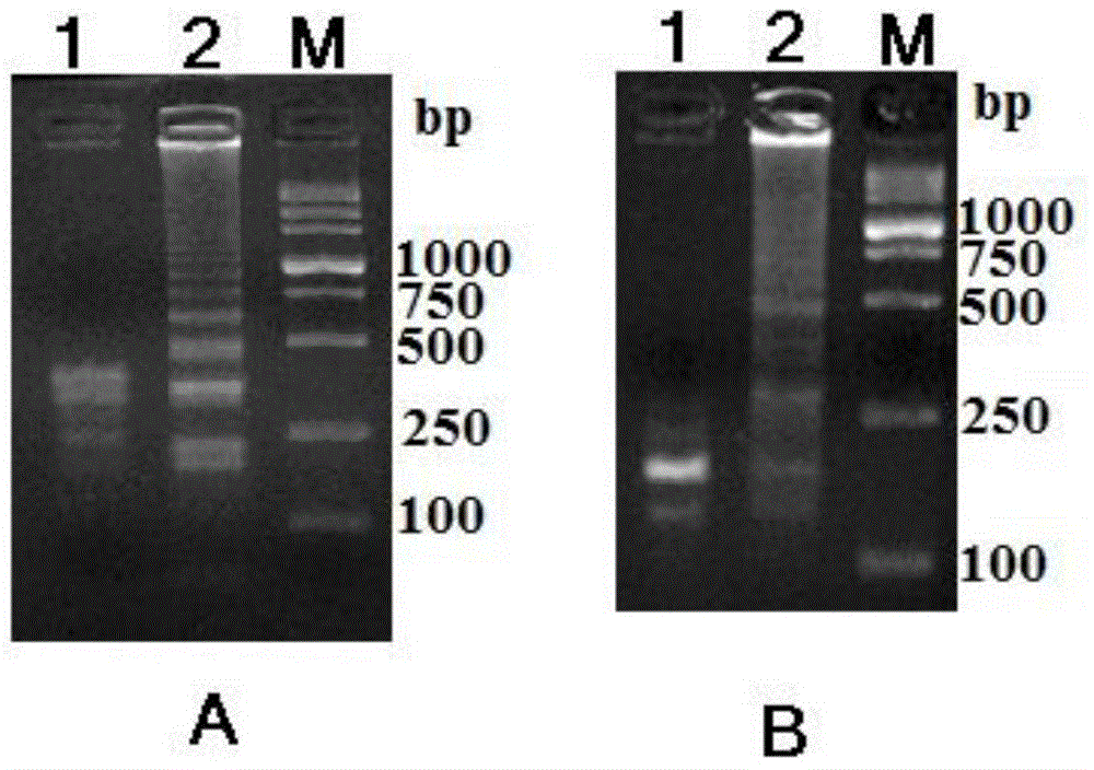 Double-LAMP (loop-mediated isothermal amplification) method for simultaneously detecting vibrio parahaemolyticus and vibrio vulnificus