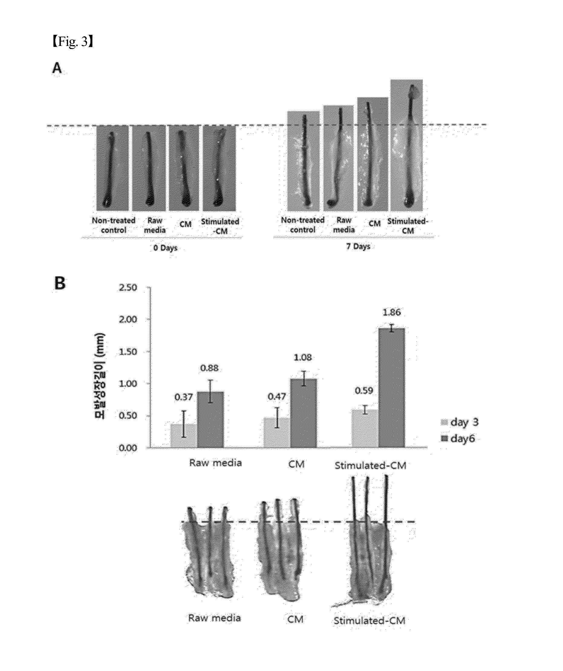 Hair growth promoting capacity of conditioned media of stimulated stem cells and use thereof