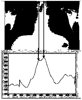 Method and device for lung segmentation in X-ray chest film