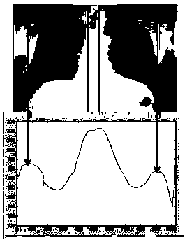 Method and device for lung segmentation in X-ray chest film