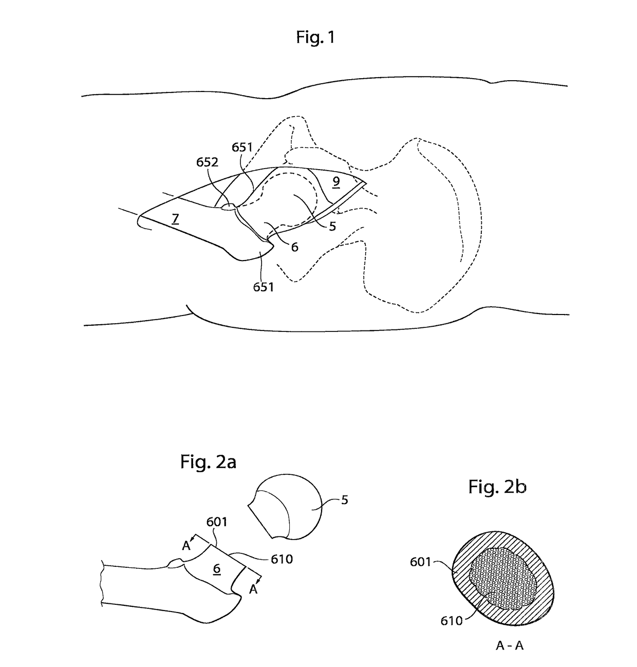 Hip joint device