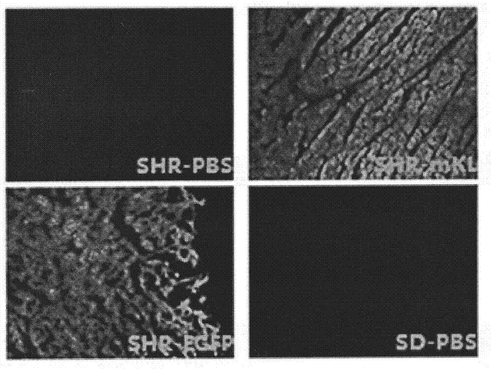 Application of Klotho adeno-associated virus to preparation of medicine for treating hypertensive heart disease of spontaneous hypertensive rat (SHR)