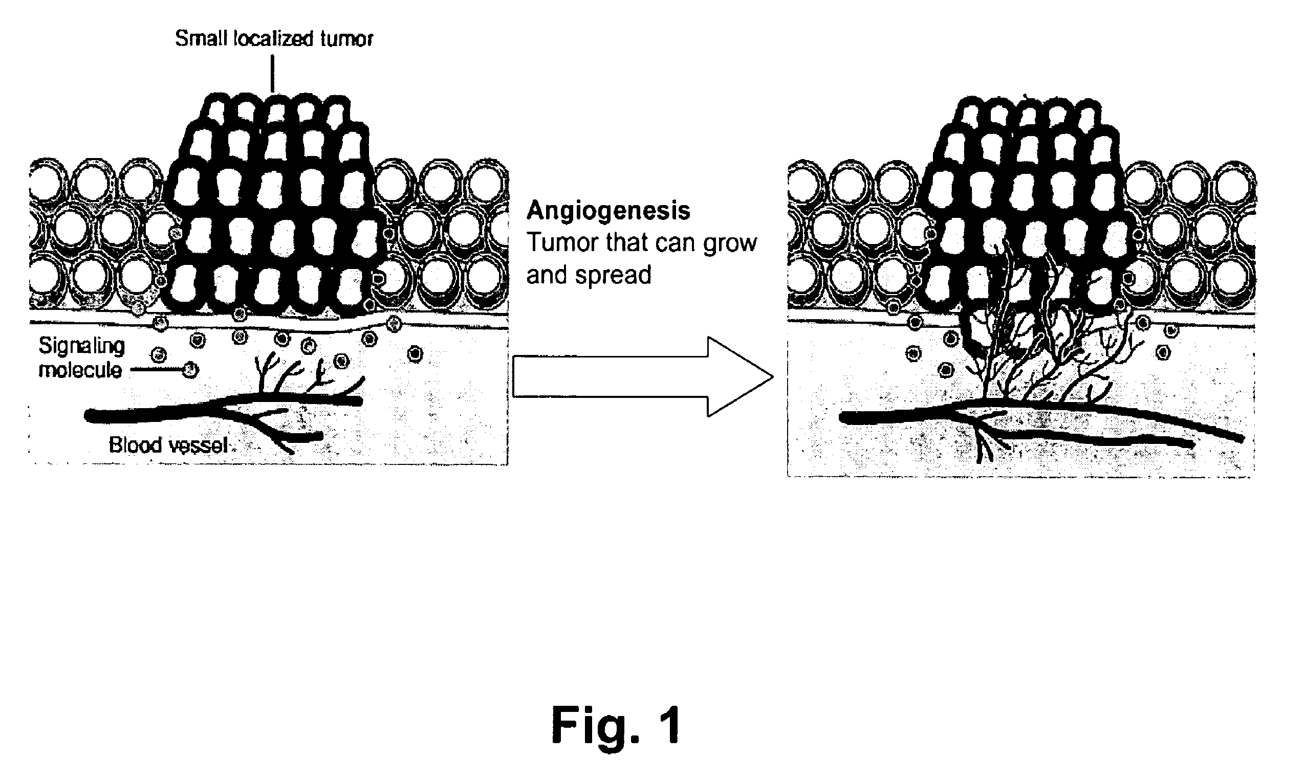 Detection of activation of endothelial cells as surrogate marker for angiogenesis