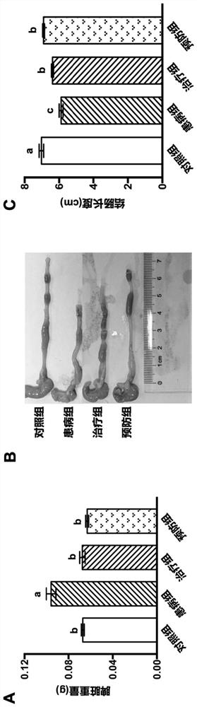 Application of glycine in prevention and/or treatment of inflammatory bowel disease