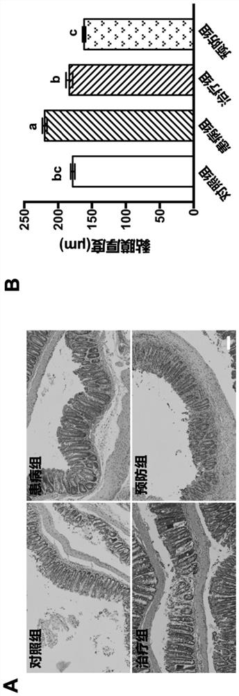 Application of glycine in prevention and/or treatment of inflammatory bowel disease