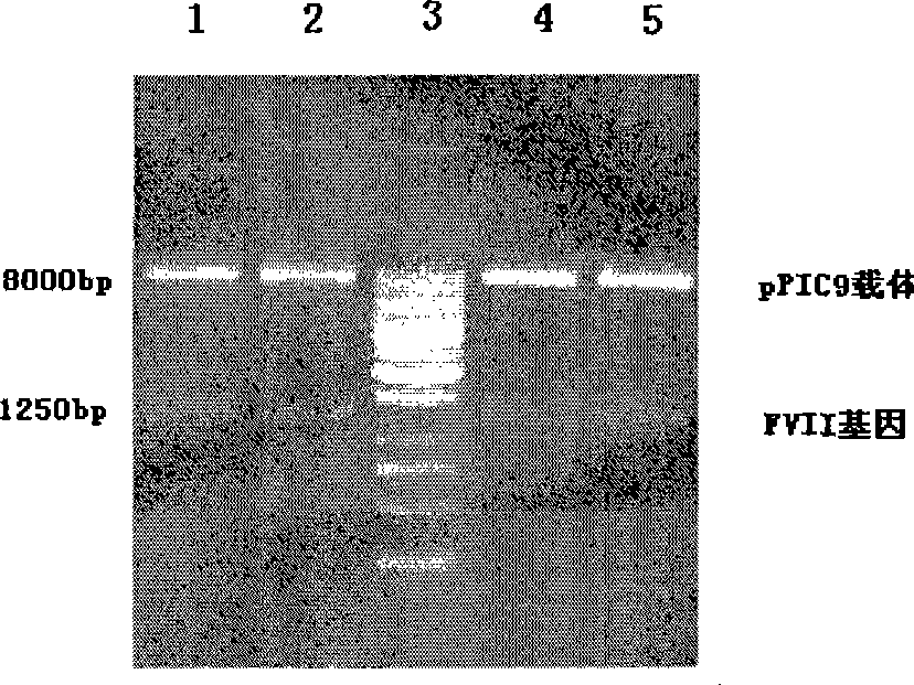 Pichia yeast expressing recombinant human blood coagulation factor VII, and preparation and use thereof