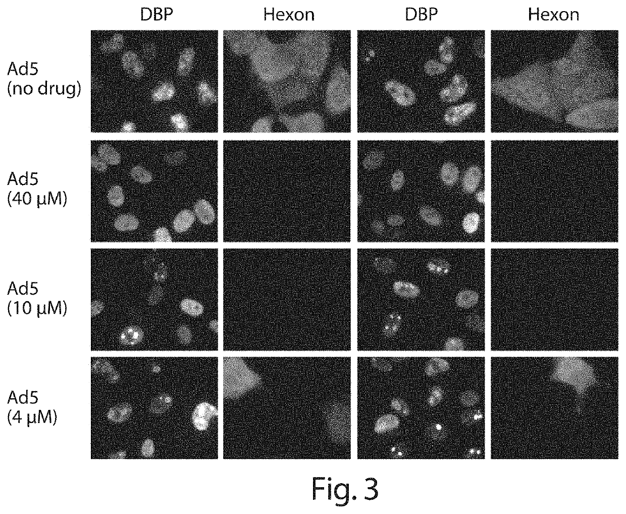 Inhibition of adenovirus with filociclovir