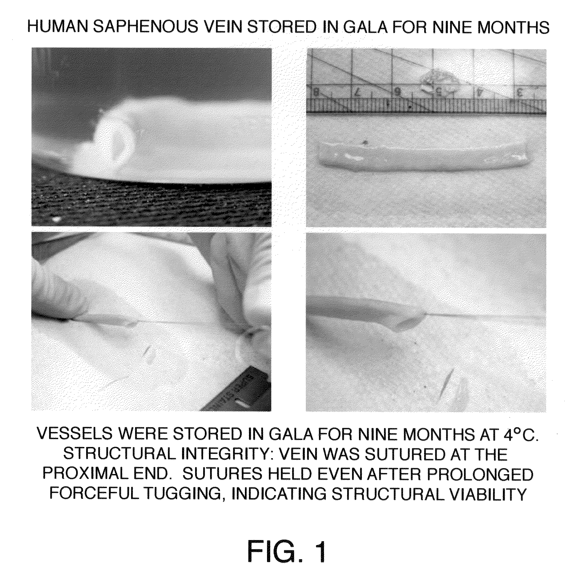 Compositions And Methods For Cardiovascular Surgery