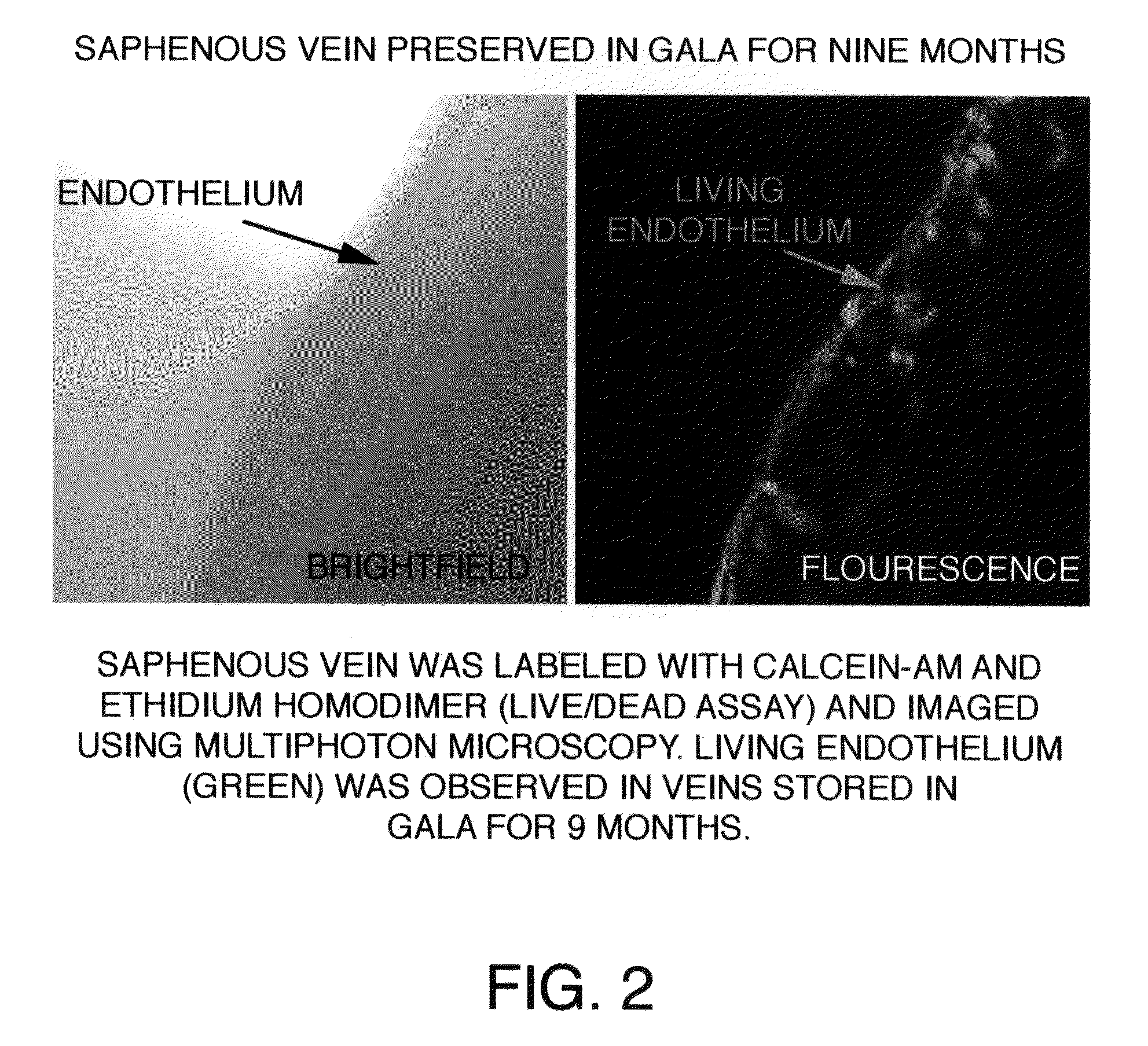 Compositions And Methods For Cardiovascular Surgery