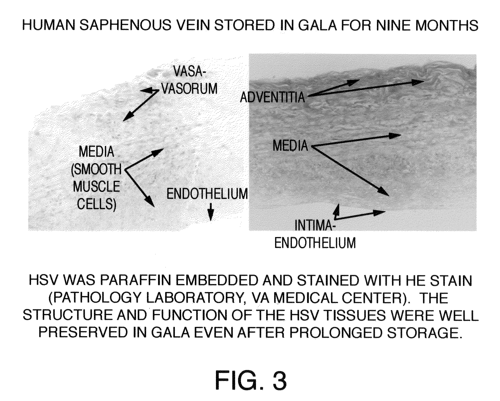 Compositions And Methods For Cardiovascular Surgery