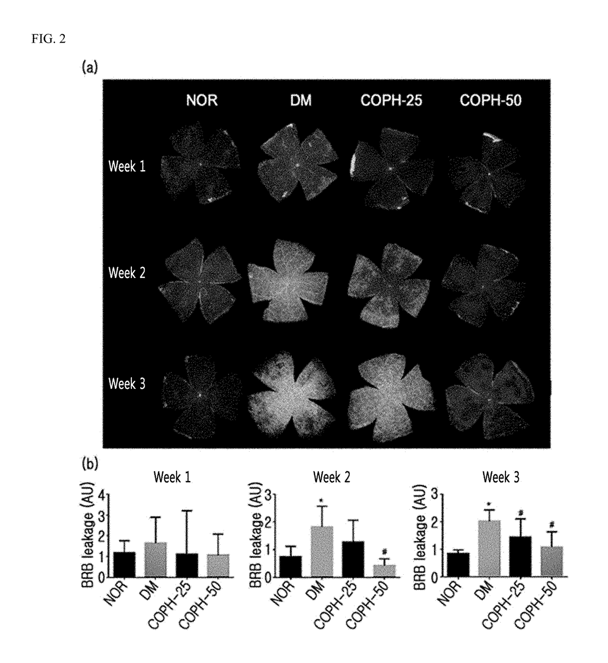 Pharmaceutical composition and functional food comprising natural extracts for preventing or treating diabetic complications or angiodema