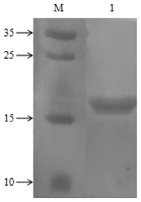 CK20 antigen, hybridoma cell strain, monoclonal antibody, and application thereof