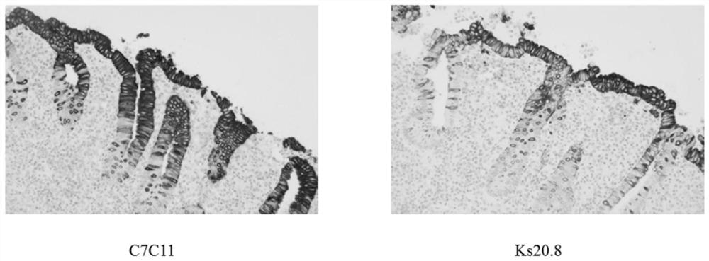 CK20 antigen, hybridoma cell strain, monoclonal antibody, and application thereof