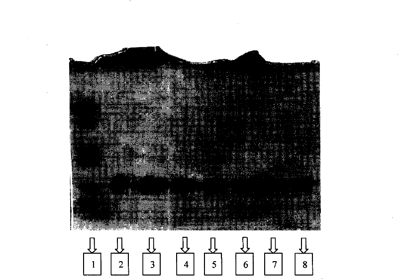 Preparation method of recombined human blood-vessel endothelia inhibin sustained-released microsphere