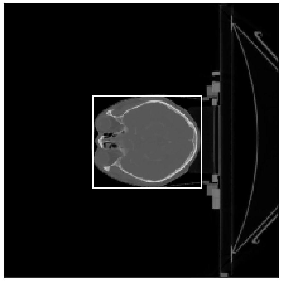 A CNN-based periocular organ segmentation method, device and storage medium