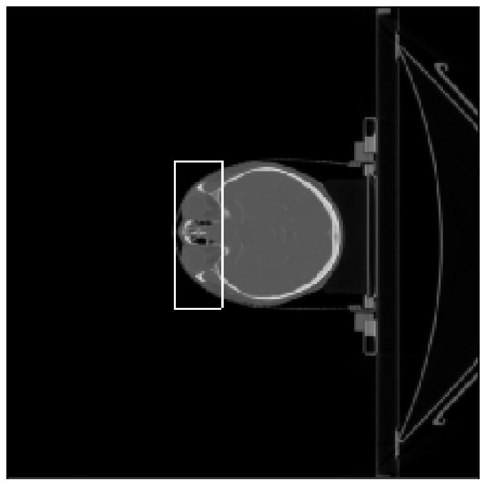 A CNN-based periocular organ segmentation method, device and storage medium