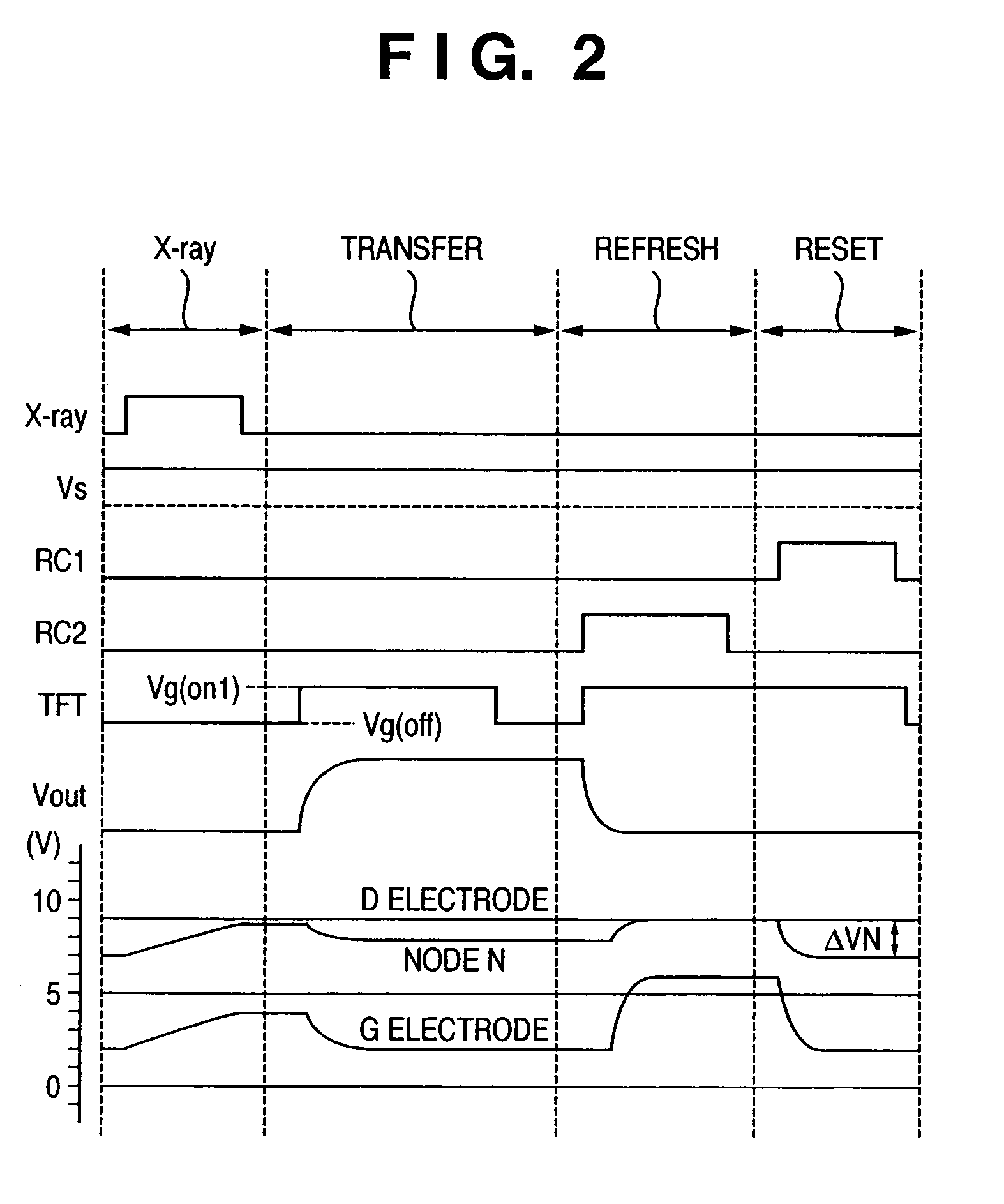 Radiographic apparatus