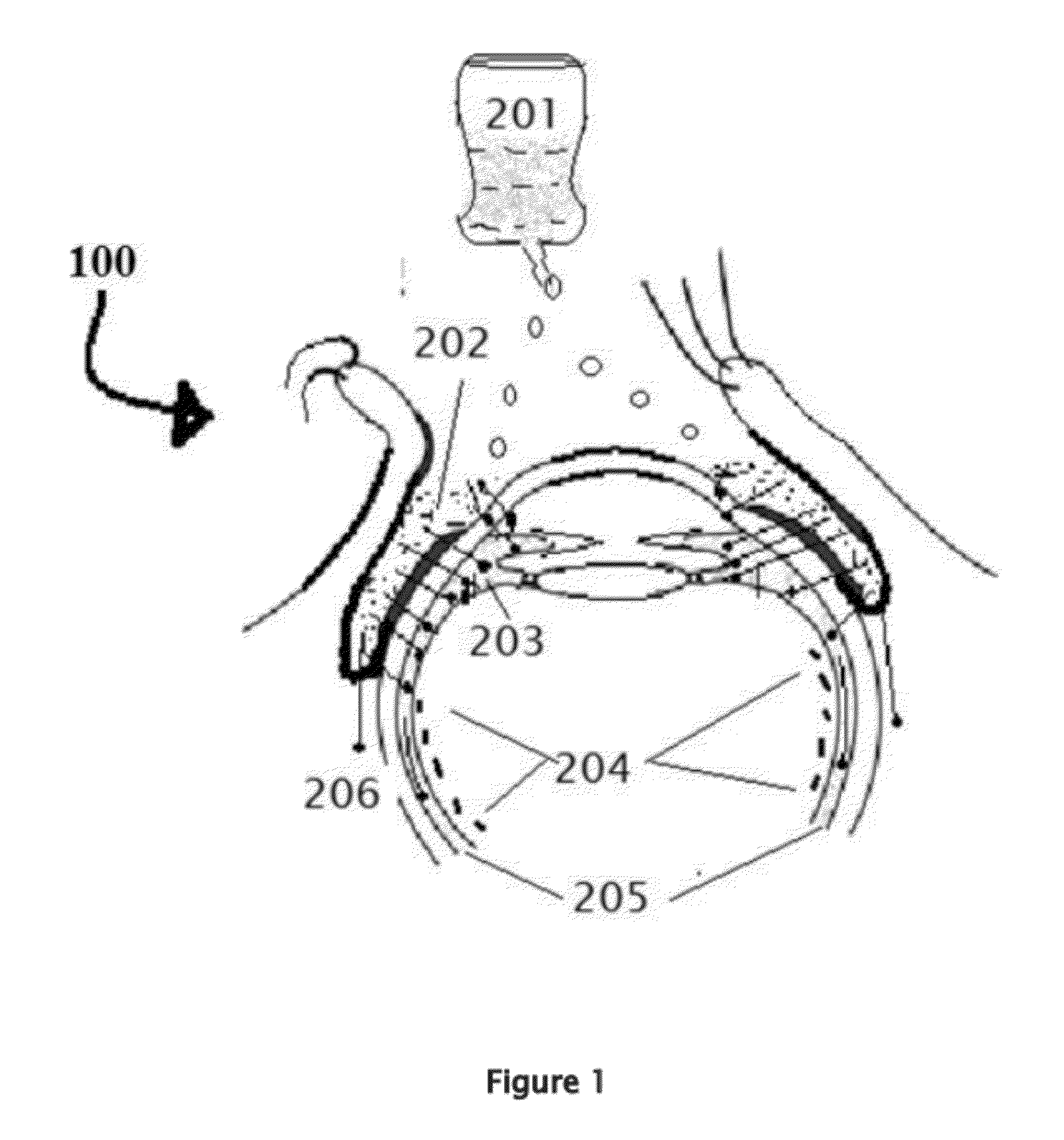 Retinitis pigmentosa treatment