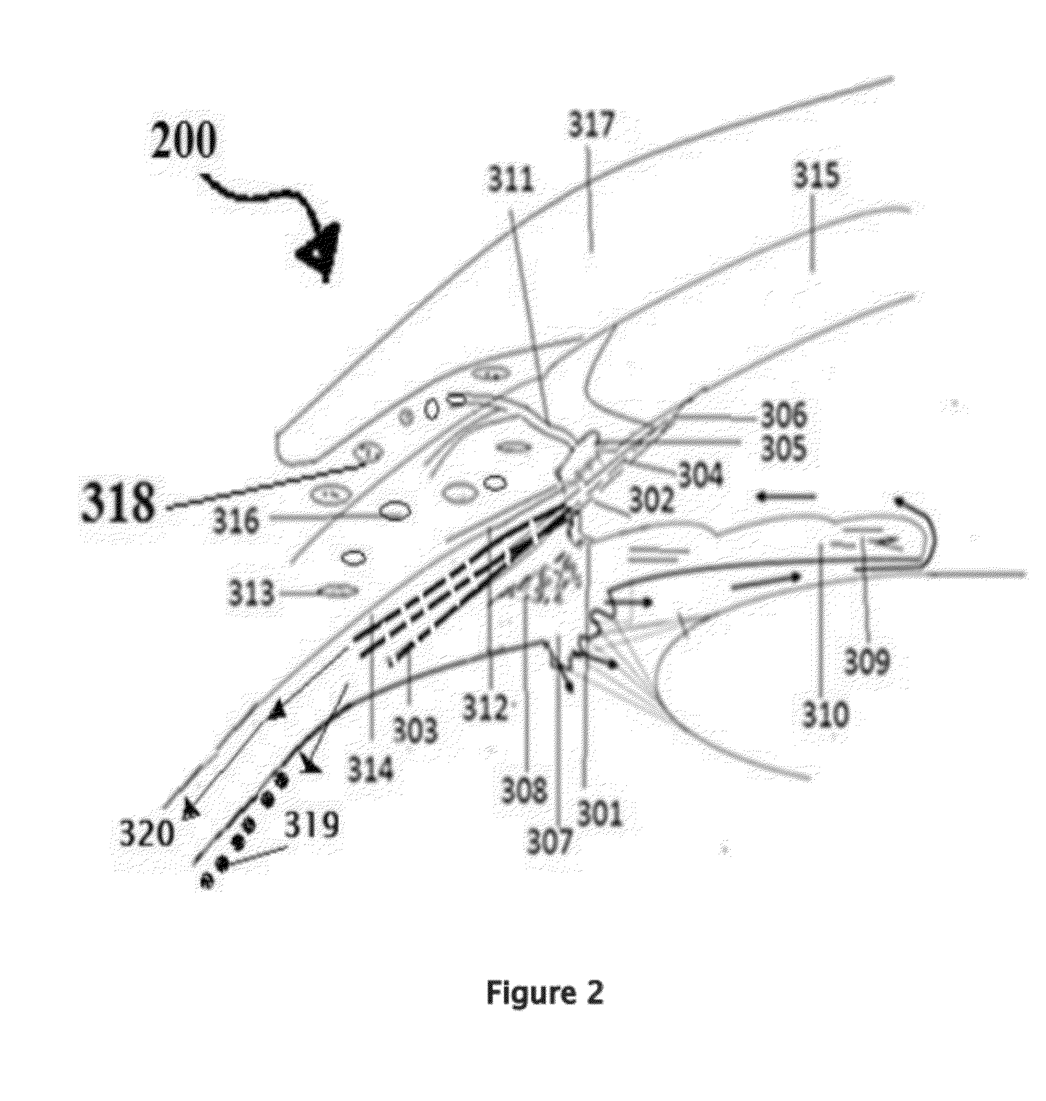 Retinitis pigmentosa treatment