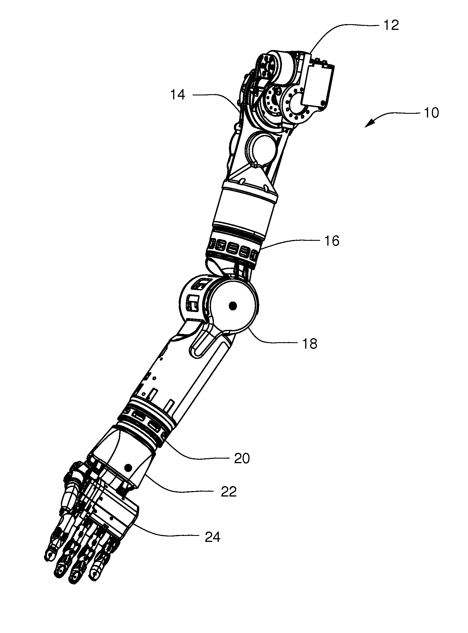 Arm Prosthetic Device