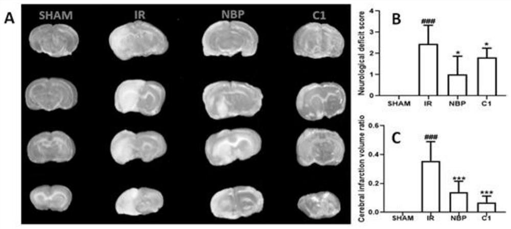 Application of a class of nucleoside analogs in the preparation of drugs for preventing and/or treating cerebrovascular diseases