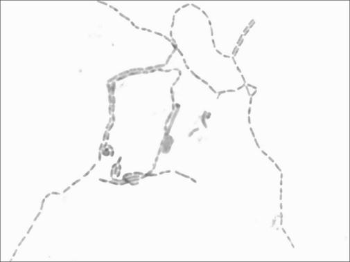 Lactobacillus rhamnosus grx19 and its application