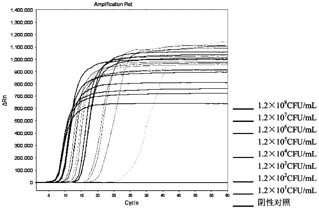 LAMP detection kit for actinobacillus pleuropneumoniae