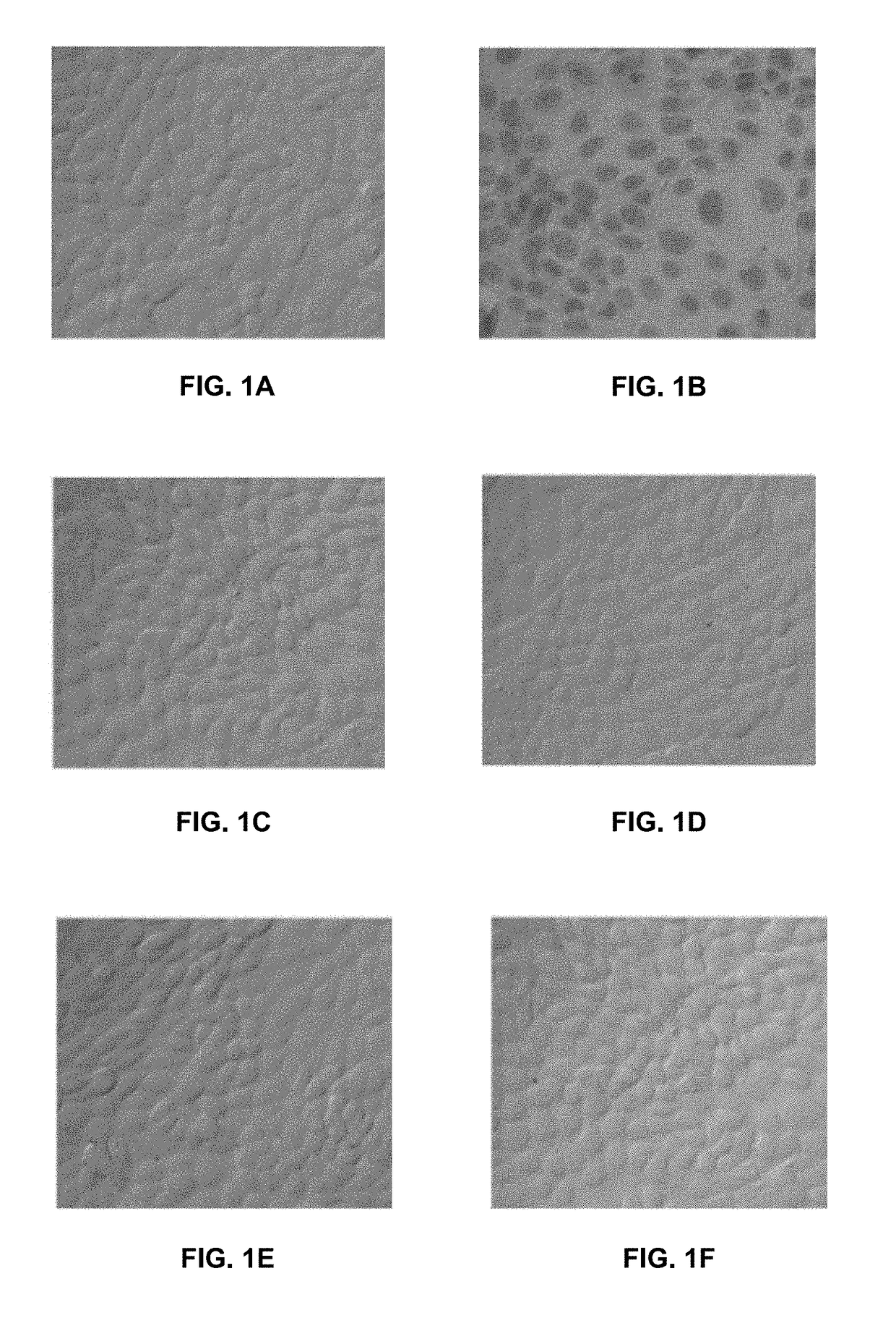 Neutral Electrolyzed Water and Uses Thereof