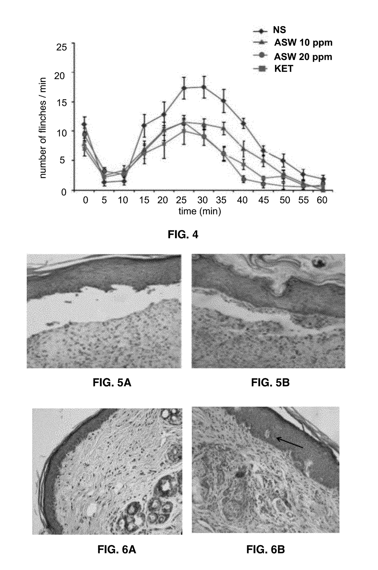 Neutral Electrolyzed Water and Uses Thereof