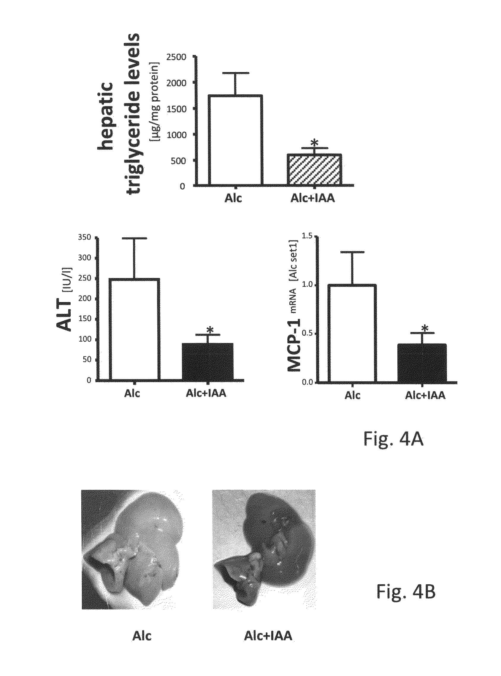 Method for preventing and/or treating the formation of injury of liver and oral composition for use in such method